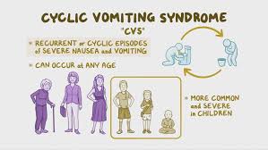 Image result for Chronic Functional Vomiting