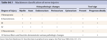 Nerve contusion or stretch leading to reversible conduction block withoutwallerian degeneration. Classification Of Nerve Injuries Plastic Surgery Key