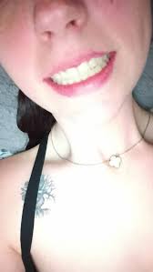 Urgent help needed for son's tooth extraction?