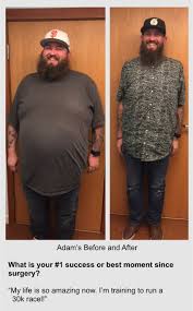 Harriett has a gastric bypass with outstanding results as you can see on the after photo. Patient Stories Southern Oregon Bariatric Center