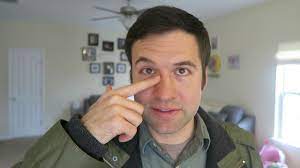 This type of hair loss usually runs in. Q A Cure Hair Loss By Going Gluten Free Youtube
