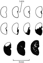 Image result for Crepidorhopalon parviflorus