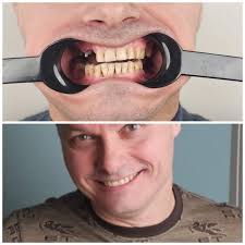 TOP-10+ Dental Implant doctors 2025