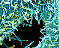 Engineered mrna with potent efficiency. Experimental Covid 19 Vaccine Safe Generates Immune Response National Institutes Of Health Nih