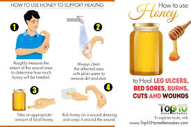 Pin On Health