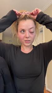 Unconventional Eyeball Appointment: Exploring Long Covid and Strange  Discoveries