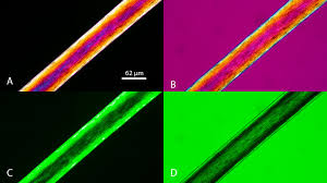 Image result for Polarized Microscopy