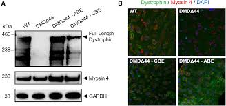 Targeting Duchenne muscular dystrophy by skipping DMD exon 45 with base  editors