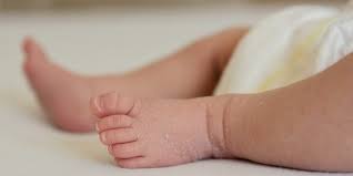 Trockene Haut Beim Baby Das Konnen Sie Gegen Trockene Hautstellen Tun