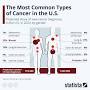 Chart: The Most Common Types of Cancer in the U.S. | Statista