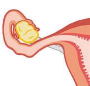 Die neue serie sex/life sorgt nach wie vor für reichlich gesprächsstoff. Scheide Vagina Gebarmutter Uterus Die Eileiter Eierstocke Ovarien Weibliche Geschlechtsorgane Korper Sexualitat Frauenarzte Im Netz Ihr Portal Fur Frauengesundheit Und Frauenheilkunde