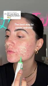 Hero Cosmetics Green Rescue Balm for Redness Control