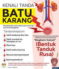 Apakah maksud oksalat penyebab batu karang buah pinggang? Kementerian Kesihatan Malaysia Batu Karang Menyebabkan Sakit Belakang Yang Teruk Yang Digambarkan Lebih Teruk Dari Sakit Waktu Bersalin Batu Karang Boleh Terbentuk Pada Buah Pinggang Nephrolithiasis Atau Di Salur Ureter Di