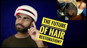 While we're on the topic, there is a difference between hair loss and hair shedding. Does Working Out Cause Hairloss Gym Routines Which Will Kill Your Hair Youtube