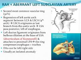 Vascular Ring Sling Vascular Subclavian Artery Ring Sling