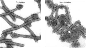 Marburg Virus Sutori