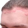 Inflammation is usually prolonged and can lead to scarring. Https Encrypted Tbn0 Gstatic Com Images Q Tbn And9gcq5zx6l1sb1fkpjmdakn4jgoltufyqm0h2vcgdiy8k6ice2gmxi Usqp Cau