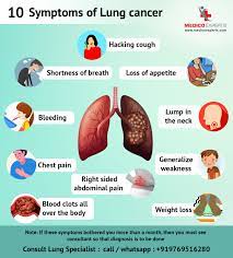 There are physical signs of lung cancer as well, including: 10 Symptoms Of Lung Cancer Medicoexperts