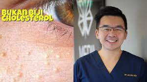 Cara menurunkan kolesterol yang pertama adalah memilih makanan yang mengandung lemak tak jenuh tunggal. Tiny Bump Bawah Mata Bukan Biji Kolesterol Dan Ini Cara Mudah Nak Hilangkan Santai Sini