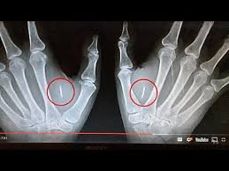 Rfid Chip Inventor Warning Message Rfid Inventor Chips