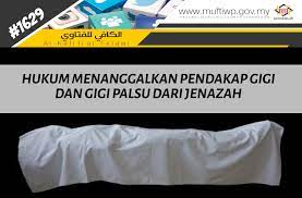 Pasang gigi palsu adalah pemasangan gigi tiruan yang bisa dilepas atau dipasang kembali untuk menggantikan gigi atau gusi yang hilang. Pejabat Mufti Wilayah Persekutuan Al Kafi 1629 Hukum Menanggalkan Pendakap Gigi Dan Gigi Palsu Dari Jenazah