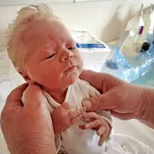 Before our second son was born, we had agreed on naming him redd, as long as he wasn't born with red hair. Baby Born With Silver Hair Due To Rare Condition That Causes Pigment Shortage In Hair Small Joys