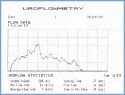 uroflowmetry used to detect the deficinecy in urinary