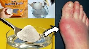 Pin On Health