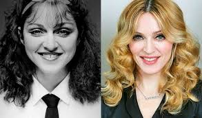 The stigma surrounding plastic surgery is disappearing as more mothers share their experiences, and why surgery was right for them. Madonna Before And After Plastic Surgery