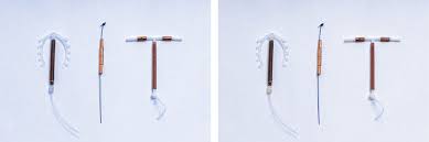 iuds and copper toxicity