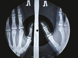 Soviet music should have been music the common workingman could understand and take pride in. Bones And Grooves The Weird Secret History Of Soviet X Ray Music Npr