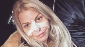 Mais quand les internautes découvrent ses photos d'avant, ils sont littéralement sous le choc. Jessica Thivenin Et Thibault Kuro Justifient Leur Chirurgie Nasale Commune Voici