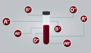 Jul 23, 2021 · most common blood type in china / blood types stanford blood center.learn how type a, b, ab, or o could impact your long term health. Racgp Can Blood Type Influence Covid Risk