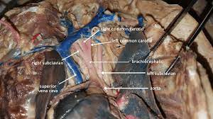 The iliac, femoral, popliteal and tibial (calf) veins are the deep veins in the legs. Blood Vessels Of Dissected Cat Docsity