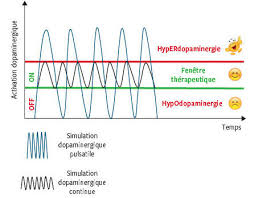 La maladie de parkinson est classée comme étant une maladie « dégénérative », mais sa cause initiale reste inconnue. Maladie De Parkinson Au Stade Avance Indication Aux Traitements Complexes