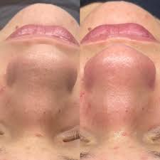 Meet The Professionals At Tonya Rae Esthetics