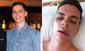 How Jack Hansen-Bartel's life turned into a nightmare after unprovoked  attack