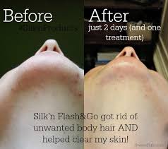 Sometimes you have sensitive skin. I Had Facial Hair And Acne A Magical Mess