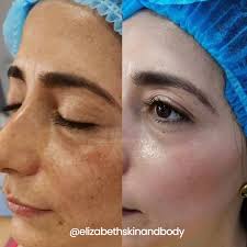 Agnew International, LLC