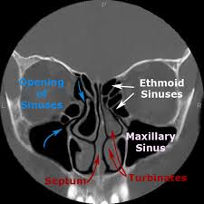 3 name the structures opening into the lateral wall of nasal cavity. Minimally Invasive Nasal Allergy And Sinus Surgery Larian Md