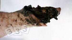Gangrene is when part of your body tissue dies. Gangrena Atlas De Patologia 3tres3 La Pagina Del Cerdo