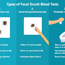 Fecal Occult Blood Test Fobt Uses Procedure Results