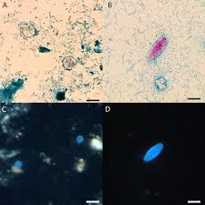 Image result for Cyclospora