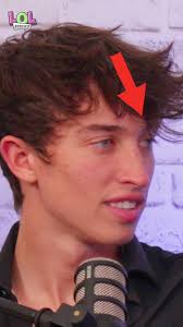 He blinks with one eye!