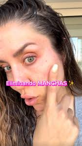 Les digo altiro que este año eliminaré no sólo los tatuajes si no también  las manchas 🙂‍↔️🫱🏼‍🫲🏻 (les iré mostrando avances ! ) , Tkm  @lorealparis , #GlycolicBright #Melasyl #SkinCare #LorealParisChile ...