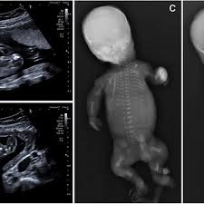 Image result for tbn:q8vpbjWx_xmJDM::pic.dll3.cc/data/media/1/babeis%2520(294