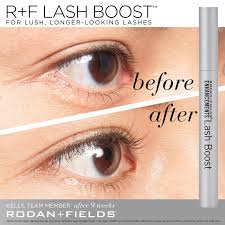 There are so many rodan and fields lash boost reviews on the internet. Rodan Fields Lash Boost Darr Dentistry