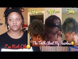 This product is specifically designed to hold down your edges like glue all day long without any residue or showing. The Truth About My Hair Loss Is The Canvas Beauty Brand Really Working For Me Youtube