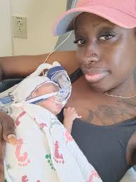 How to ensure continued growth of affected limbs after hemispherectomy?