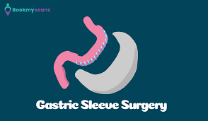 Pin On Bariatric Surgery In Bangalore